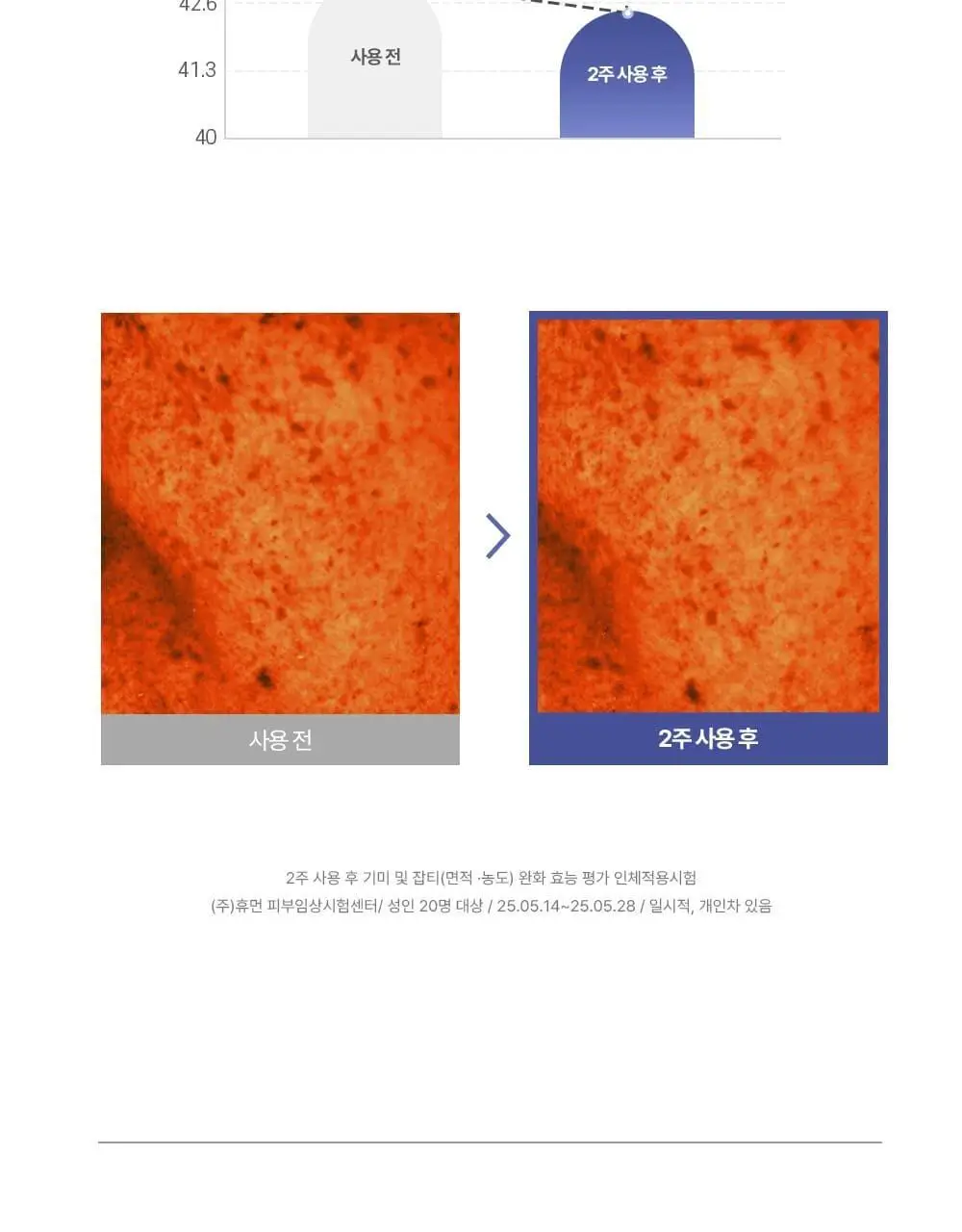 [붙이는 아이크림] 에이바자르 리쥬브네이팅 아이 링클 컨트롤 마스크 (5P/더블기획) 상세페이지 11